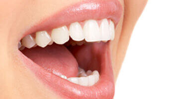 Komplette Zahnsanierungen