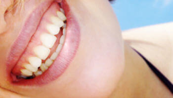 Zahnfleischkorrekturen
